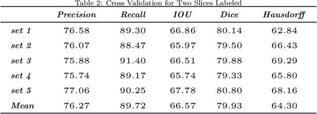 Figure 4 for Seismic Fault Segmentation via 3D-CNN Training by a Few 2D Slices Labels