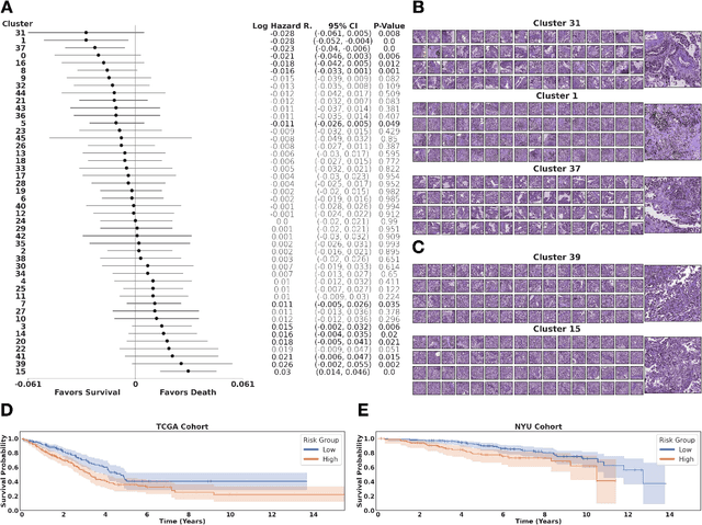 Figure 3 for Self-supervised learning unveils morphological clusters behind lung cancer types and prognosis