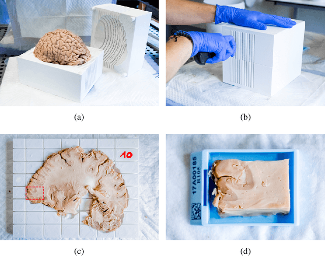 Figure 1 for Initial condition assessment for reaction-diffusion glioma growth models: A translational MRI/histology (in)validation study