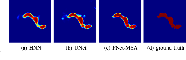 Figure 2 for Pancreas Segmentation in CT and MRI Images via Domain Specific Network Designing and Recurrent Neural Contextual Learning