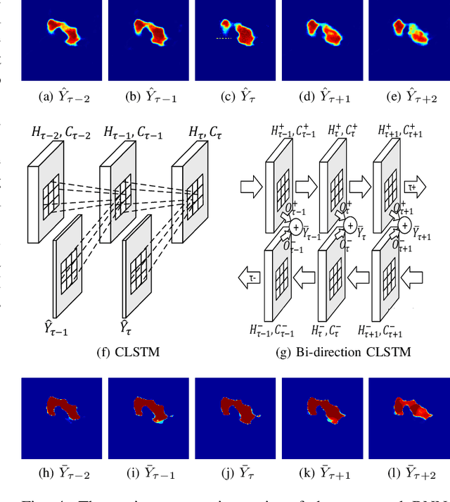 Figure 4 for Pancreas Segmentation in CT and MRI Images via Domain Specific Network Designing and Recurrent Neural Contextual Learning