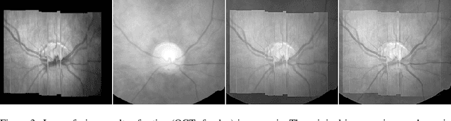 Figure 4 for Image Fusion via Sparse Regularization with Non-Convex Penalties