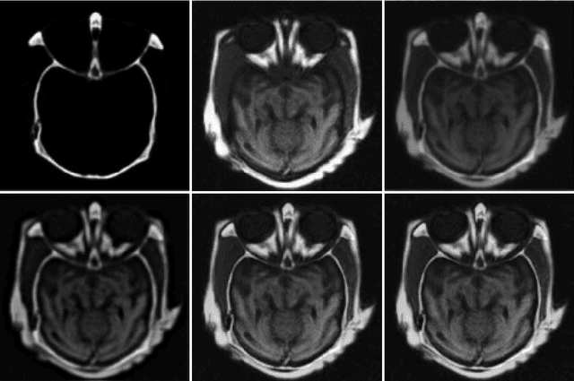 Figure 1 for Image Fusion via Sparse Regularization with Non-Convex Penalties