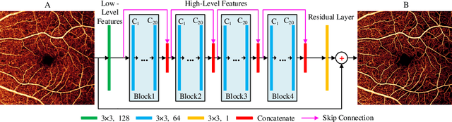 Figure 3 for Reconstruction of high-resolution 6x6-mm OCT angiograms using deep learning