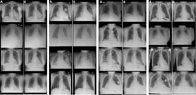 Figure 1 for Generative Visual Rationales