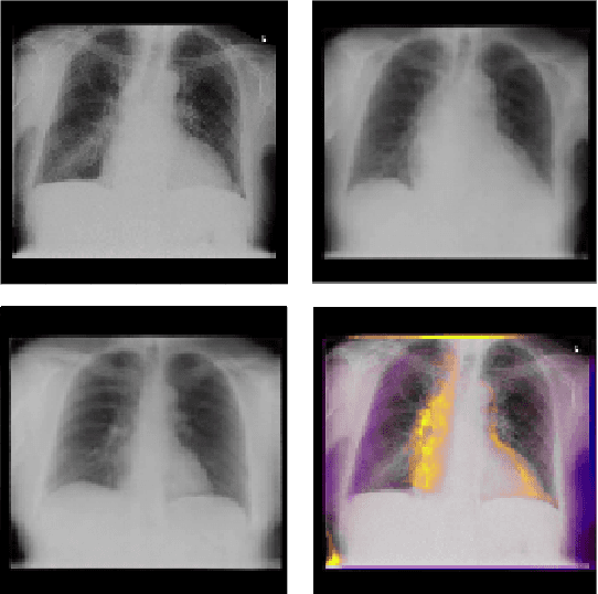 Figure 4 for Generative Visual Rationales