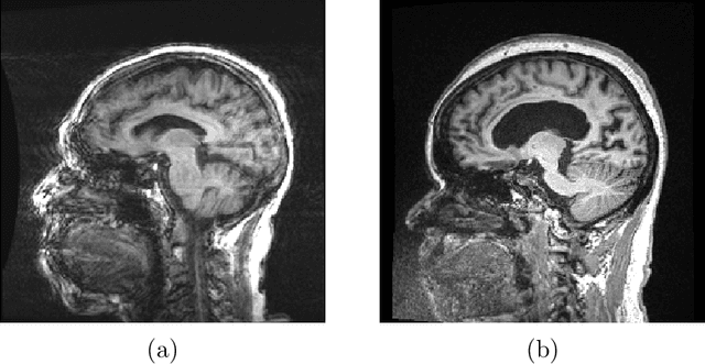 Figure 1 for A Decoupled Uncertainty Model for MRI Segmentation Quality Estimation
