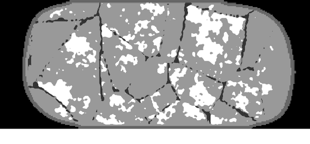 Figure 4 for Deep learning reconstruction of digital breast tomosynthesis images for accurate breast density and patient-specific radiation dose estimation