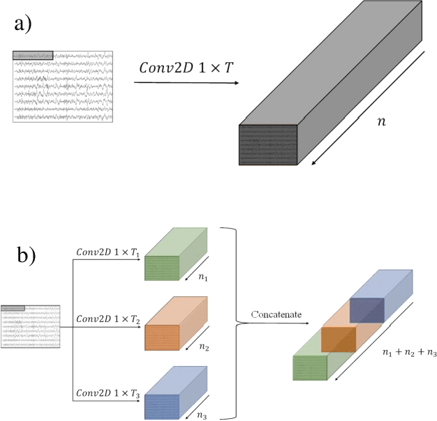 Figure 1 for EEG-ITNet: An Explainable Inception Temporal Convolutional Network for Motor Imagery Classification