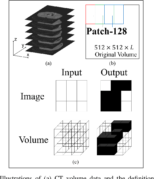 Figure 1 for Z-Net: an Asymmetric 3D DCNN for Medical CT Volume Segmentation