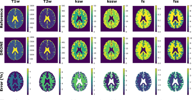Figure 4 for Development of a Clinical Chemical Exchange Saturation Transfer MR fingerprinting (CEST-MRF) Pulse Sequence and Reconstruction for Brain Tumor Quantification
