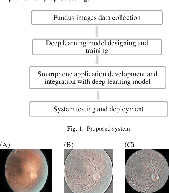 Figure 1 for Automated Smartphone based System for Diagnosis of Diabetic Retinopathy