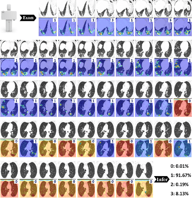 Figure 3 for M3Lung-Sys: A Deep Learning System for Multi-Class Lung Pneumonia Screening from CT Imaging