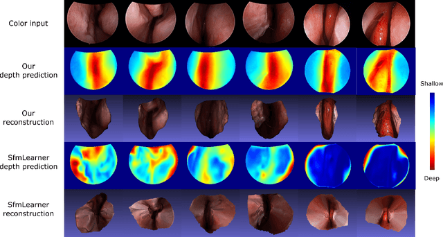 Figure 2 for Self-supervised Learning for Dense Depth Estimation in Monocular Endoscopy