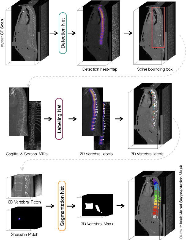Figure 4 for VerSe: A Vertebrae Labelling and Segmentation Benchmark