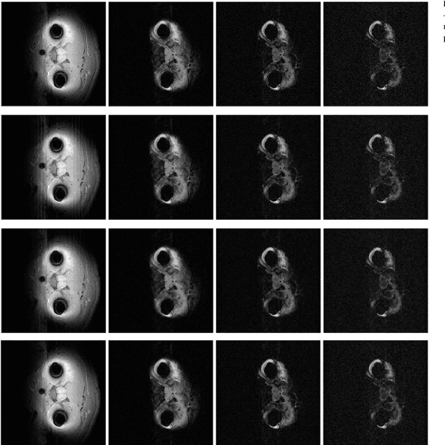 Figure 4 for Multi-echo Reconstruction from Partial K-space Scans via Adaptively Learnt Basis