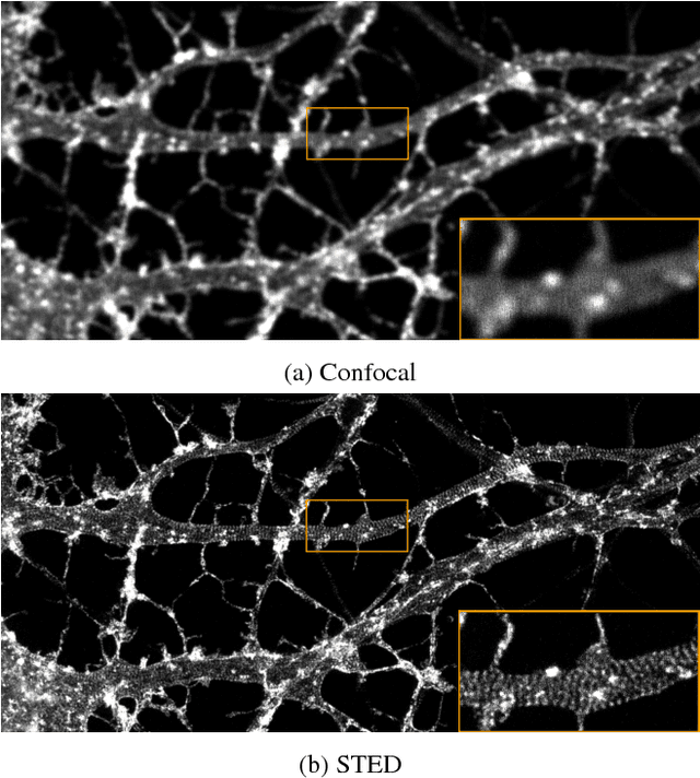 Figure 3 for Learning to Become an Expert: Deep Networks Applied To Super-Resolution Microscopy
