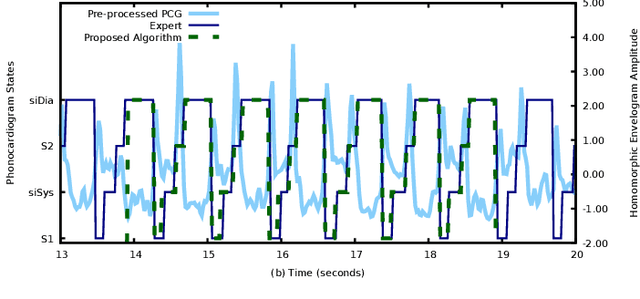 Figure 4 for Segmentation and Optimal Region Selection of Physiological Signals using Deep Neural Networks and Combinatorial Optimization
