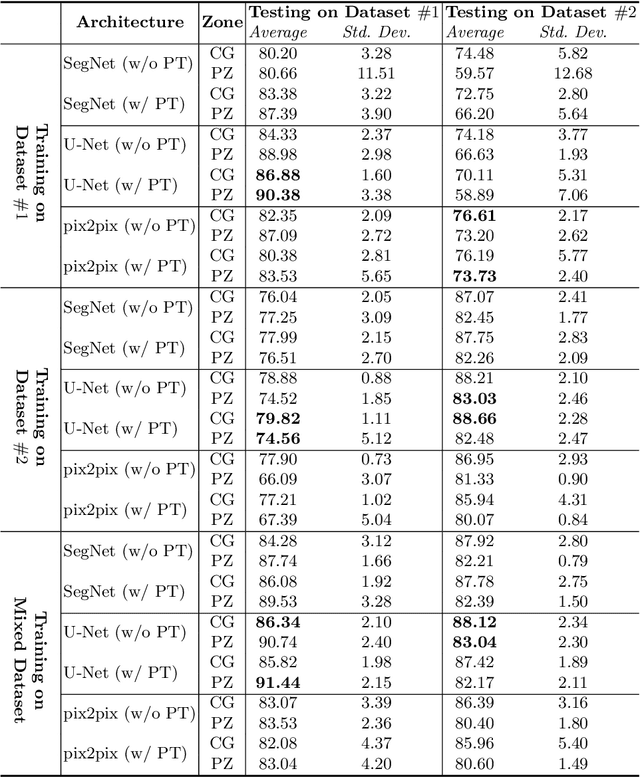Figure 2 for CNN-based Prostate Zonal Segmentation on T2-weighted MR Images: A Cross-dataset Study