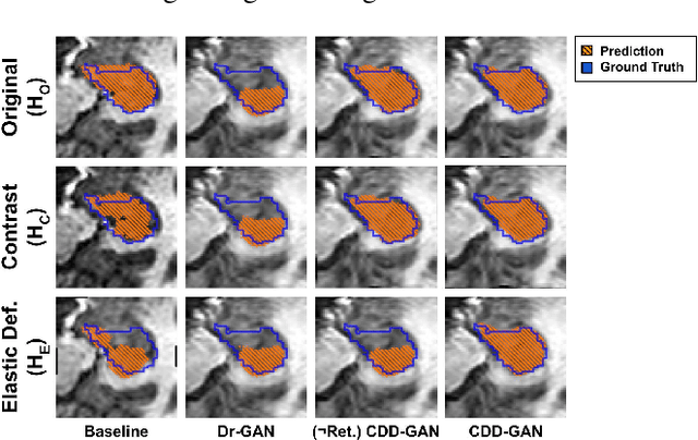 Figure 4 for Disentanglement enables cross-domain Hippocampus Segmentation