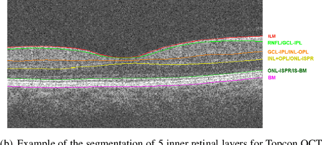 Figure 1 for Segmentation-guided Domain Adaptation and Data Harmonization of Multi-device Retinal Optical Coherence Tomography using Cycle-Consistent Generative Adversarial Networks