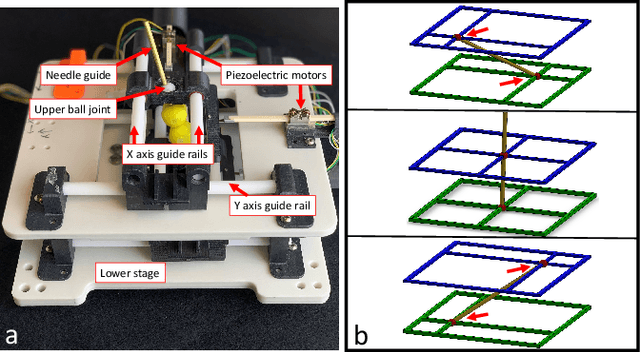 Figure 1 for Resolution-Enhanced MRI-Guided Navigation of Spinal Cellular Injection Robot
