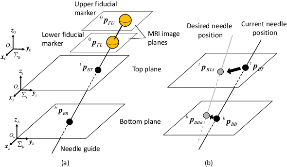 Figure 4 for Resolution-Enhanced MRI-Guided Navigation of Spinal Cellular Injection Robot
