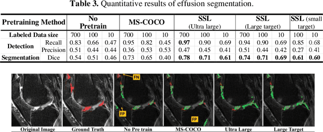 Figure 4 for Self-Supervised-RCNN for Medical Image Segmentation with Limited Data Annotation