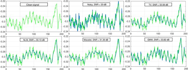 Figure 1 for Compressive Sensing of ECG Signals using Plug-and-Play Regularization