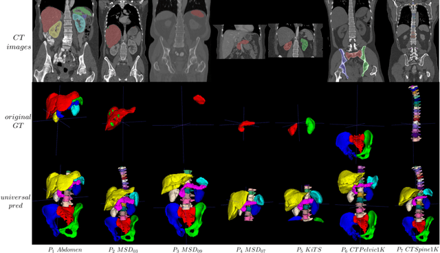Figure 1 for Universal Segmentation of 33 Anatomies