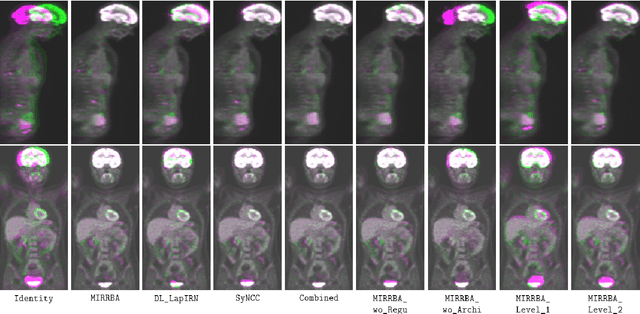 Figure 4 for Deformable Image Registration with Deep Network Priors: a Study on Longitudinal PET Images