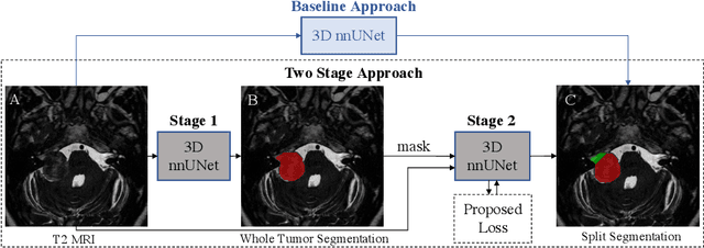 Figure 1 for Boundary Distance Loss for Intra-/Extra-meatal Segmentation of Vestibular Schwannoma