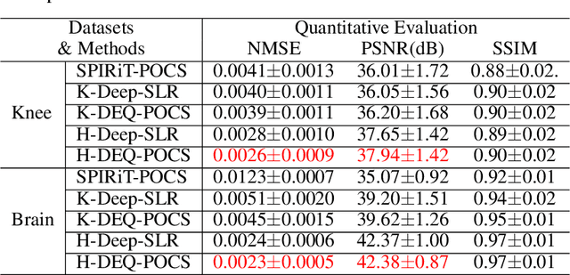 Figure 2 for Equilibrated Zeroth-Order Unrolled Deep Networks for Accelerated MRI