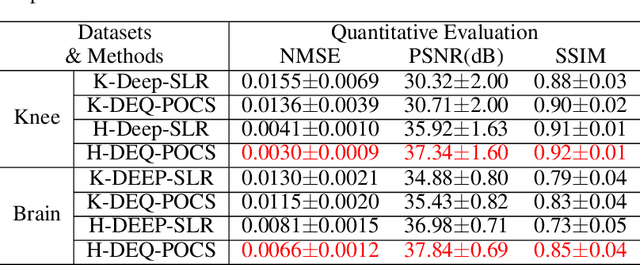 Figure 4 for Equilibrated Zeroth-Order Unrolled Deep Networks for Accelerated MRI