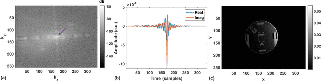 Figure 1 for A High-Dynamic-Range Digital RF-Over-Fiber Link for MRI Receive Coils Using Delta-Sigma Modulation