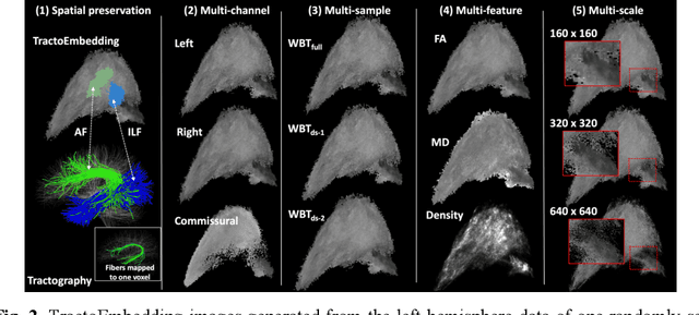 Figure 3 for TractoFormer: A Novel Fiber-level Whole Brain Tractography Analysis Framework Using Spectral Embedding and Vision Transformers