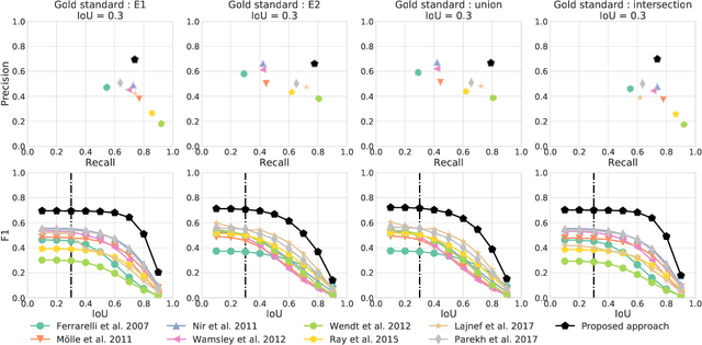Figure 3 for A deep learning architecture to detect events in EEG signals during sleep
