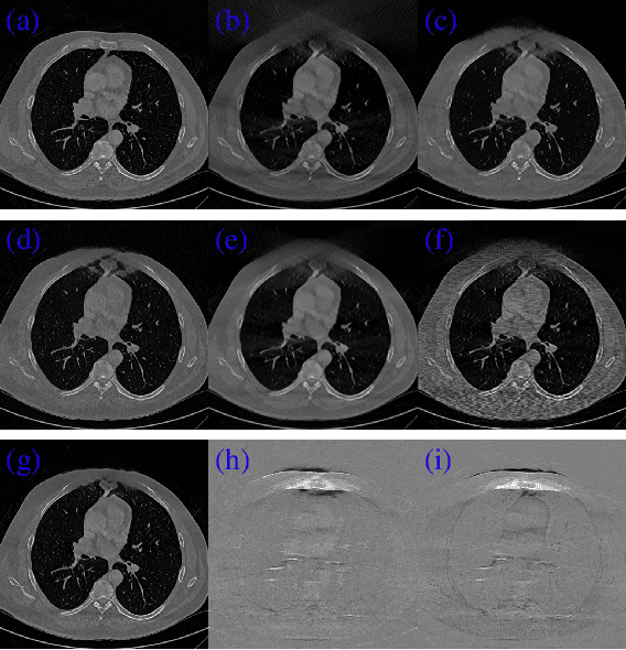 Figure 3 for JSR-Net: A Deep Network for Joint Spatial-Radon Domain CT Reconstruction from incomplete data