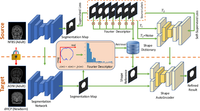 Figure 1 for Source-free Domain Adaptation for Multi-site and Lifespan Brain Skull Stripping