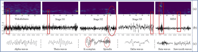 Figure 1 for Enhancement on Model Interpretability and Sleep Stage Scoring Performance with A Novel Pipeline Based on Deep Neural Network