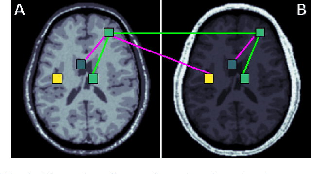 Figure 1 for Learning an MR acquisition-invariant representation using Siamese neural networks