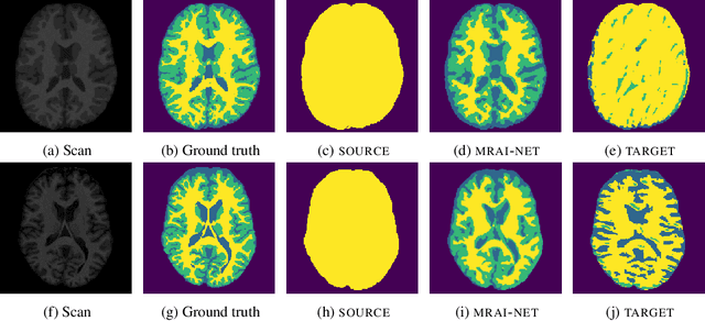 Figure 3 for Learning an MR acquisition-invariant representation using Siamese neural networks