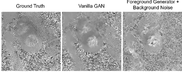 Figure 3 for HDL: Hybrid Deep Learning for the Synthesis of Myocardial Velocity Maps in Digital Twins for Cardiac Analysis