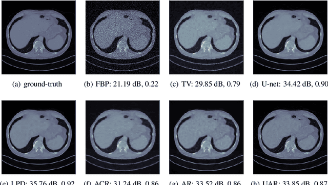 Figure 2 for End-to-end reconstruction meets data-driven regularization for inverse problems