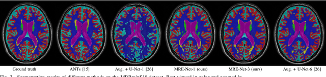 Figure 3 for A Unified Framework for Generalized Low-Shot Medical Image Segmentation with Scarce Data