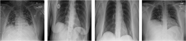 Figure 3 for MEDUSA: Multi-scale Encoder-Decoder Self-Attention Deep Neural Network Architecture for Medical Image Analysis