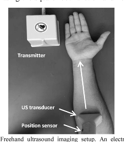 Figure 2 for Sparsity Analysis of a Sonomyographic Muscle-Computer Interface