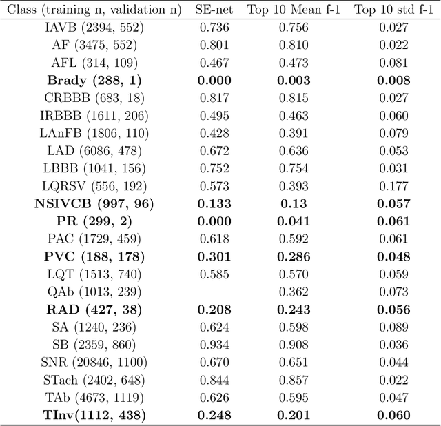 Figure 4 for Analysis of an adaptive lead weighted ResNet for multiclass classification of 12-lead ECGs