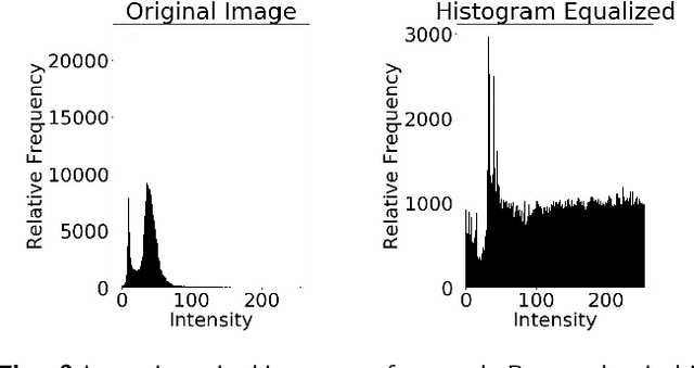 Figure 3 for Feature Fusion of Raman Chemical Imaging and Digital Histopathology using Machine Learning for Prostate Cancer Detection