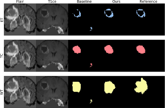 Figure 4 for Knowledge distillation from multi-modal to mono-modal segmentation networks